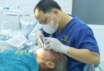5 ĐIỀU GIÚP BẠN THAY ĐỔI KHÔNG NGỜ KHI DÁN RĂNG SỨ VENEER TẠI NHA KHOA AN PHÚ