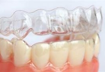 MÁNG TRỊ NGHIẾN